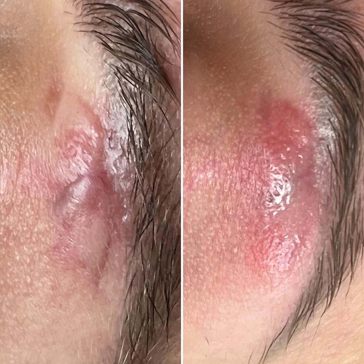 Слева ДО, справа ПОСЛЕ