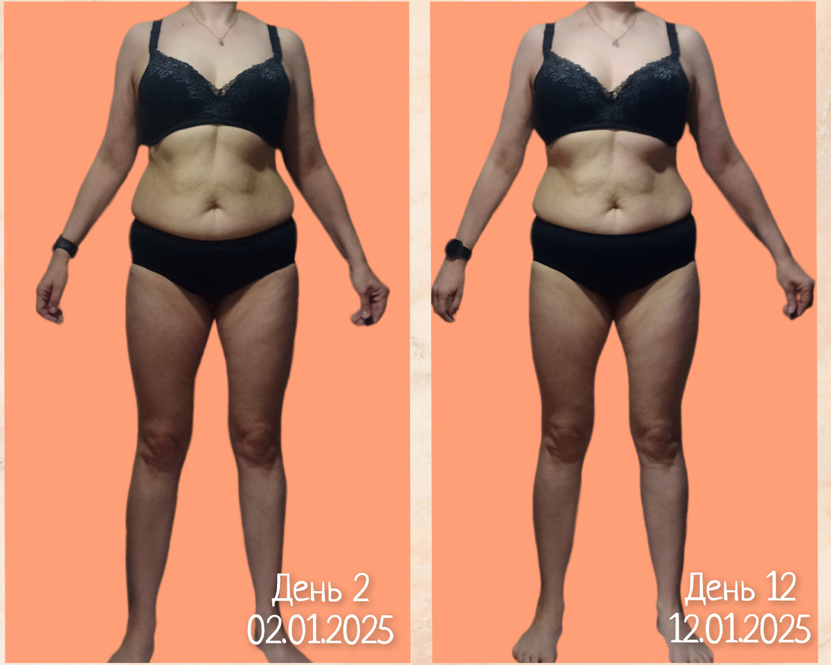 Вид спереди