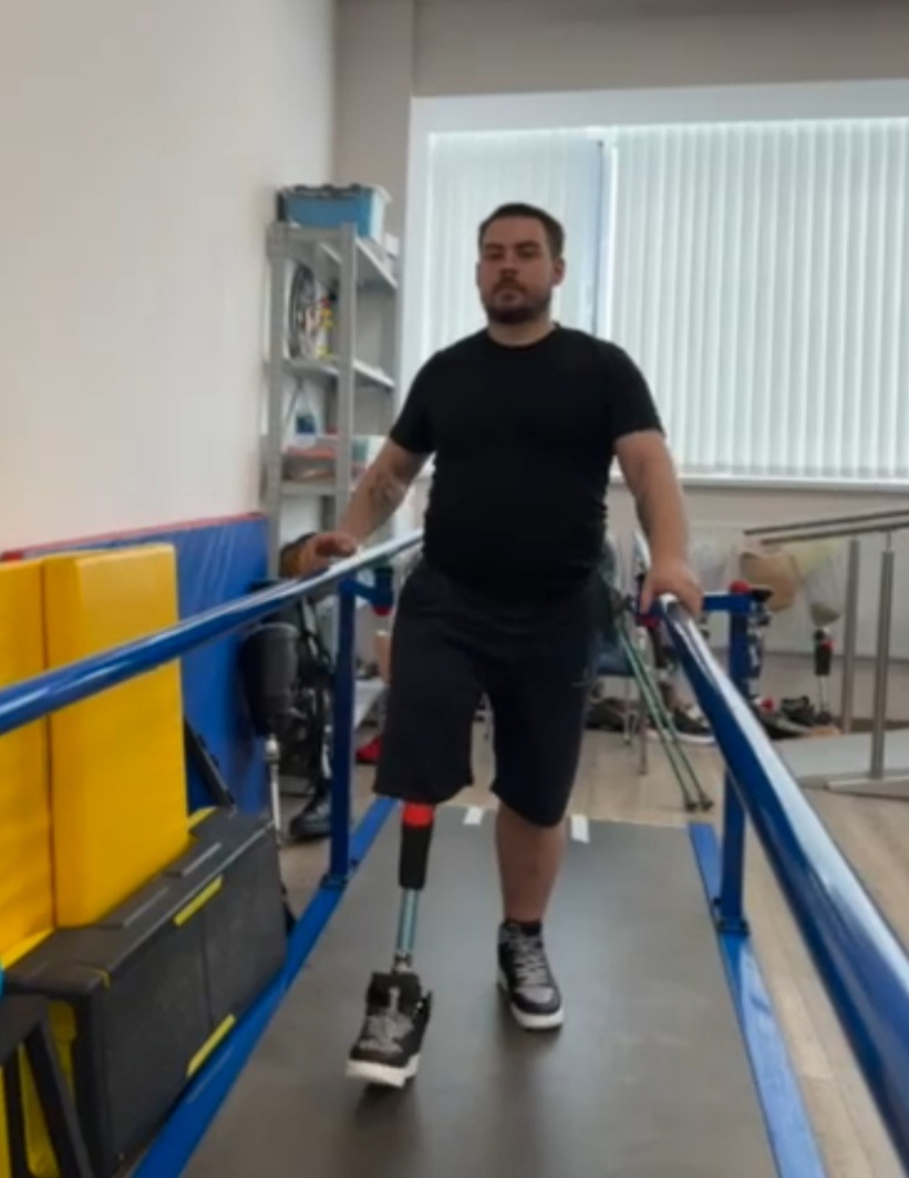 (Тренировки на косметическом протезе очень болезненны). 