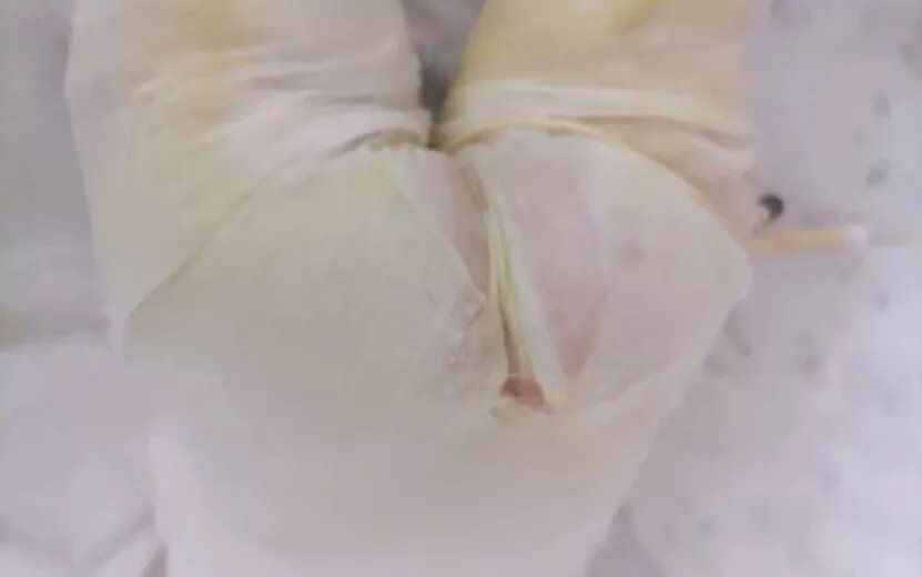    В реанимации с ожогами: в детсаду 181 Ижевска проводят проверку после сообщений о ЧП с ребенком