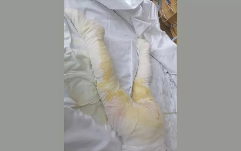    Следком организовал проверку после сообщений в соцсетях об ожогах ребенка в детском саду