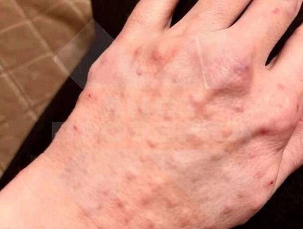 Фото: Telegram-канал Shot