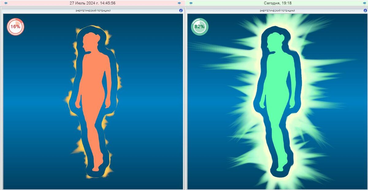 Диагностика в программе Лотос-Оникс