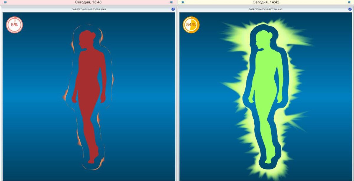 Диагностика в программе Лотос-Оникс