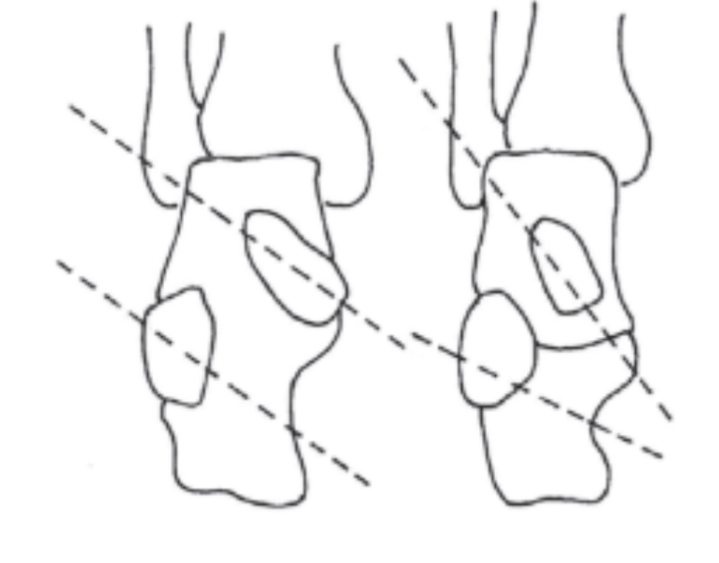 Рис. 2 Оси движения среднеплюсневого сустава.
