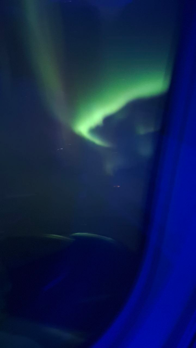 Я проснулась от мигрени и просто повернула голову. Восторг мой был не передаваем!