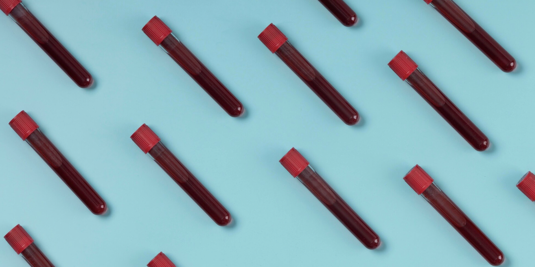 Эти 10 анализов крови продлят вашу жизнь