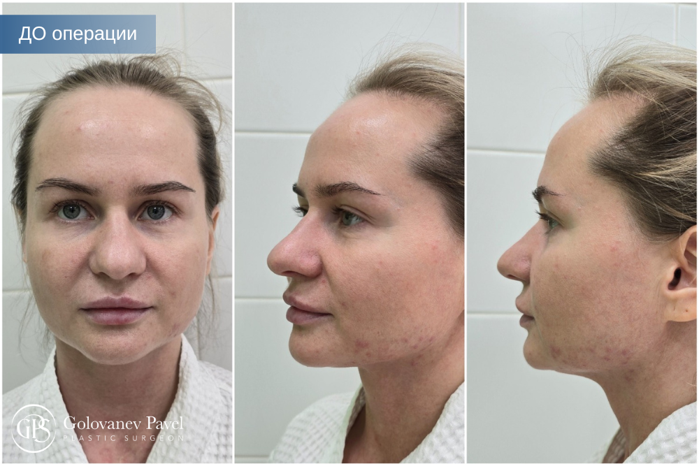 Пациентка ДО операции