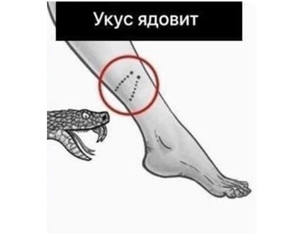 Укус ядовитой змеи можно отличить по следам клыков