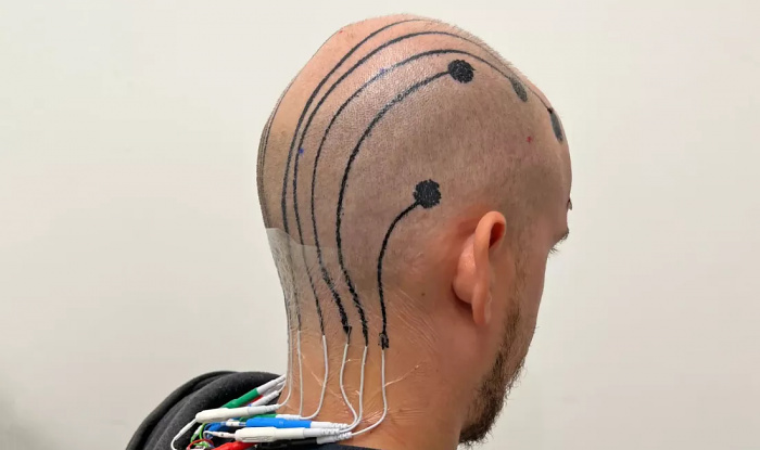 Электронные тату помогаю делать ЭЭГ эффективнее