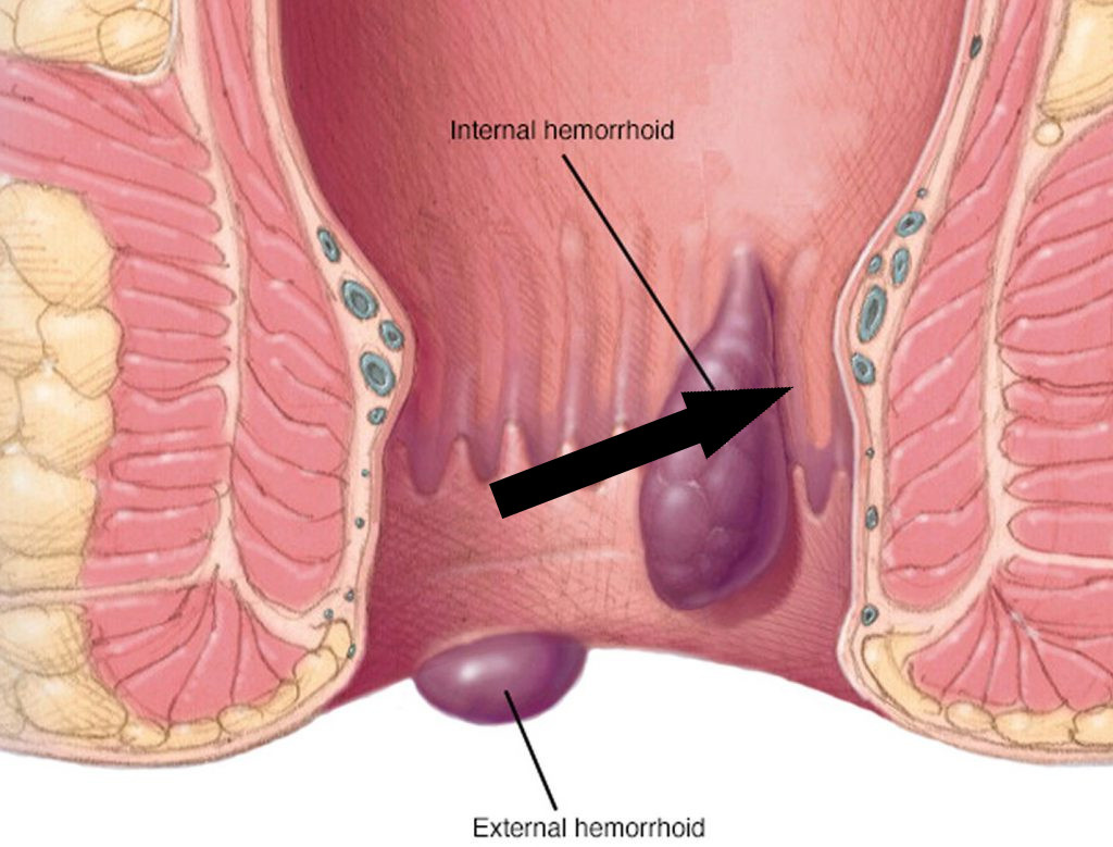    Неуловимый бегун