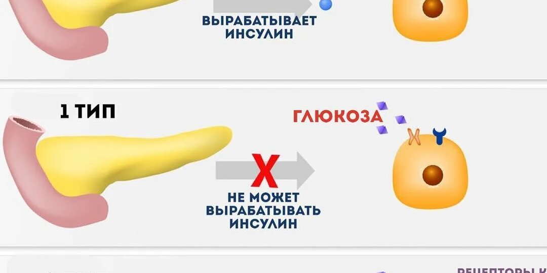 Диабет у мужчин: понятным языком о проблеме и решениях