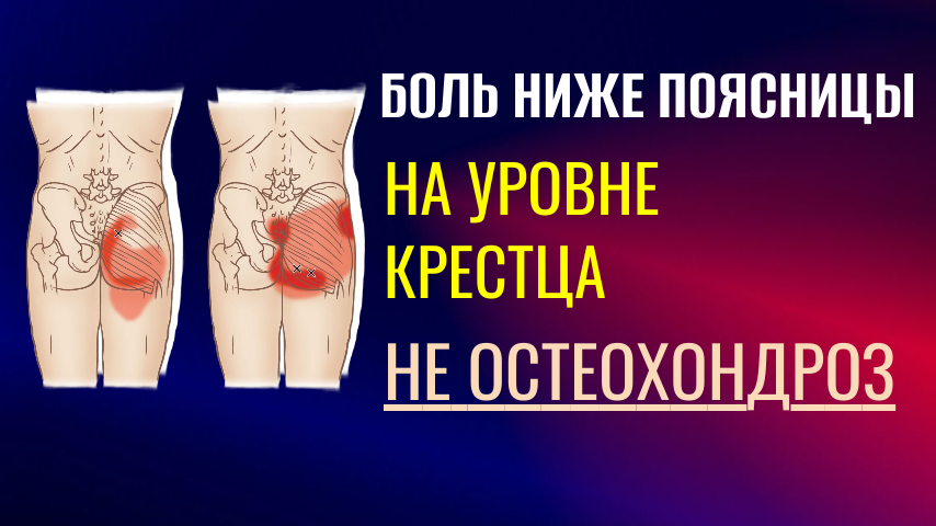ЛФК при боль ниже поясницы, на уровне крестеца. Причины боли, готовые упражнения.