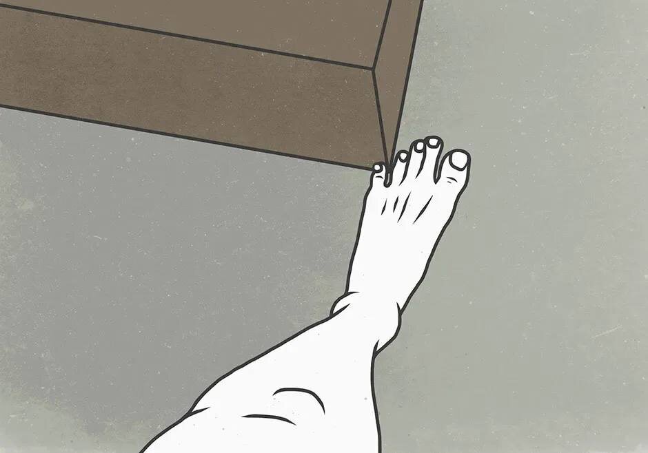 Примерный уровень боли