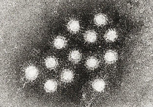    Вирус гепатита A / Источник: Cdc.gov