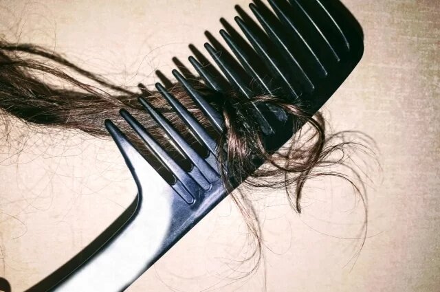    Что нужно проверить, если зимой выпадают волосы?