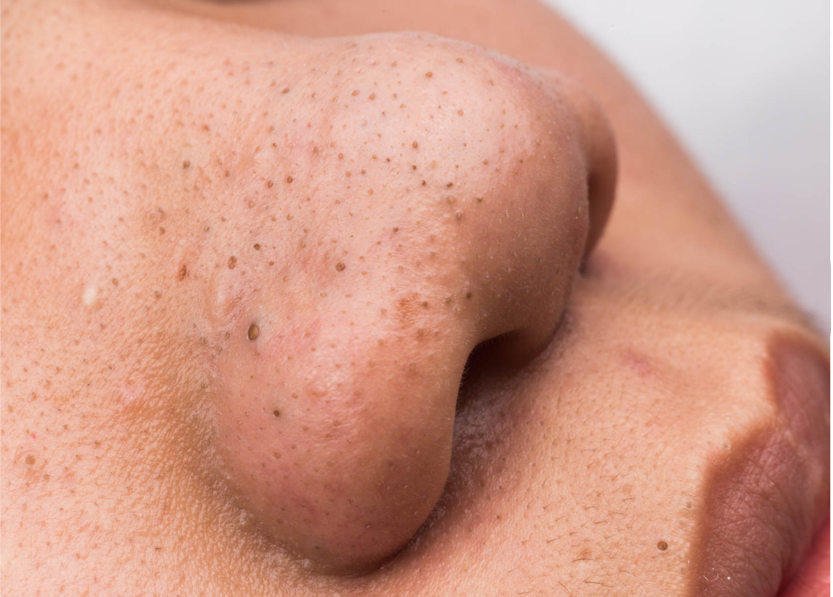 Черные точки.