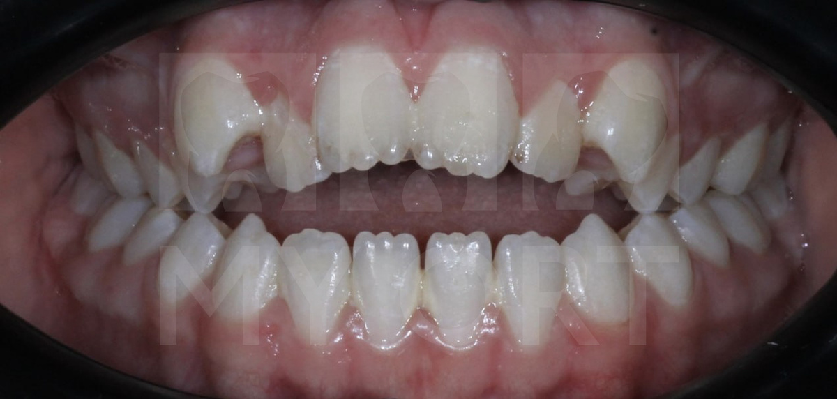 Ситуация ДО лечения