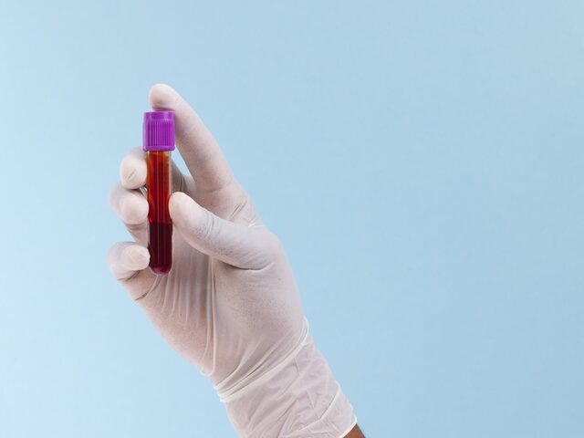    Фото: 123RF/vectorfusionart