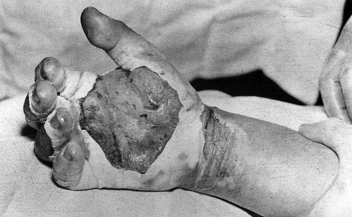 Рука, которой Даглян сбил злополучный брусок