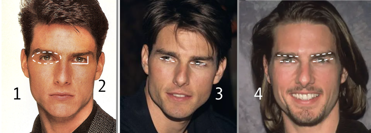 #1 - компактные глазницы, что означает хорошую поддержку костей и исключает провисание мягких тканей #2 - миндалевидная форма глаз, соотношение около 1/3 #3 -  позитивный кантальный наклон #4 - малое расстояние между глазами и бровями, считается привлекательным