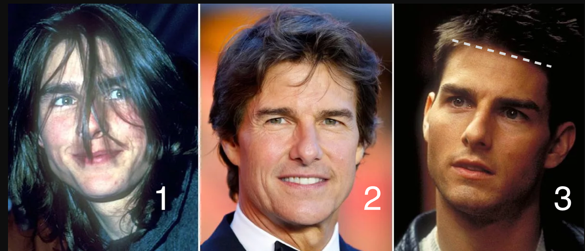 #1 - отличная текстура и плотность волос #2 - здоровый и ровный цвет кожи #3 - идеальная линия роста волос