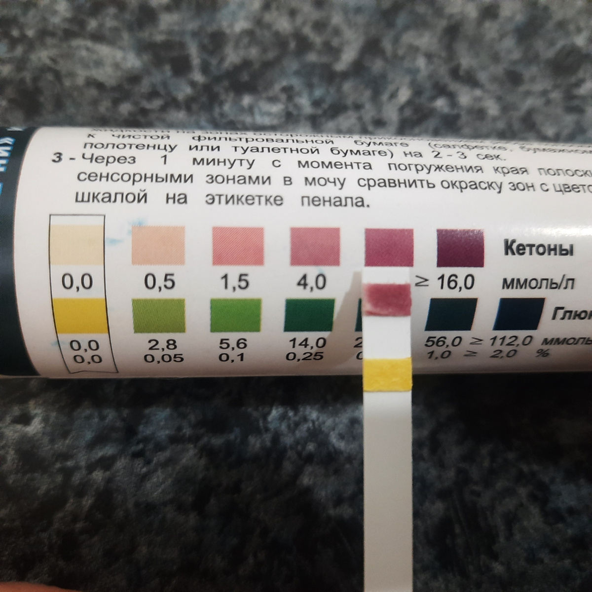 Высокий кетоз.