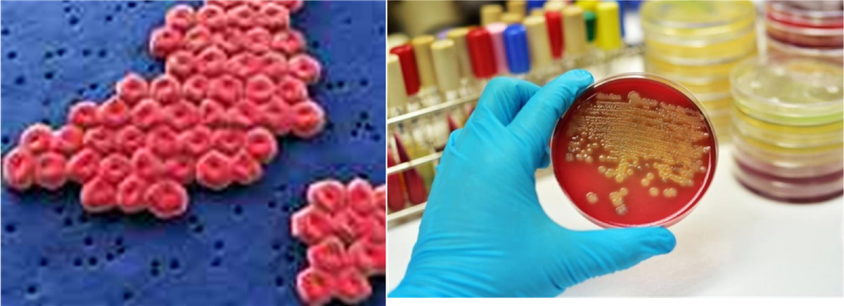 Слева: бактерии рода Acinetobacter под микроскопом. Справа: микробиологический посев биологического материала. Источник изображения; https://www.krasotaimedicina.ru