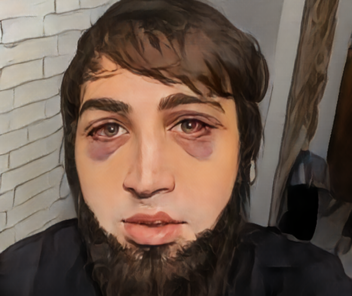 Нам пришлось подредактировать фото, чтобы площадка не отправила нас в бан 