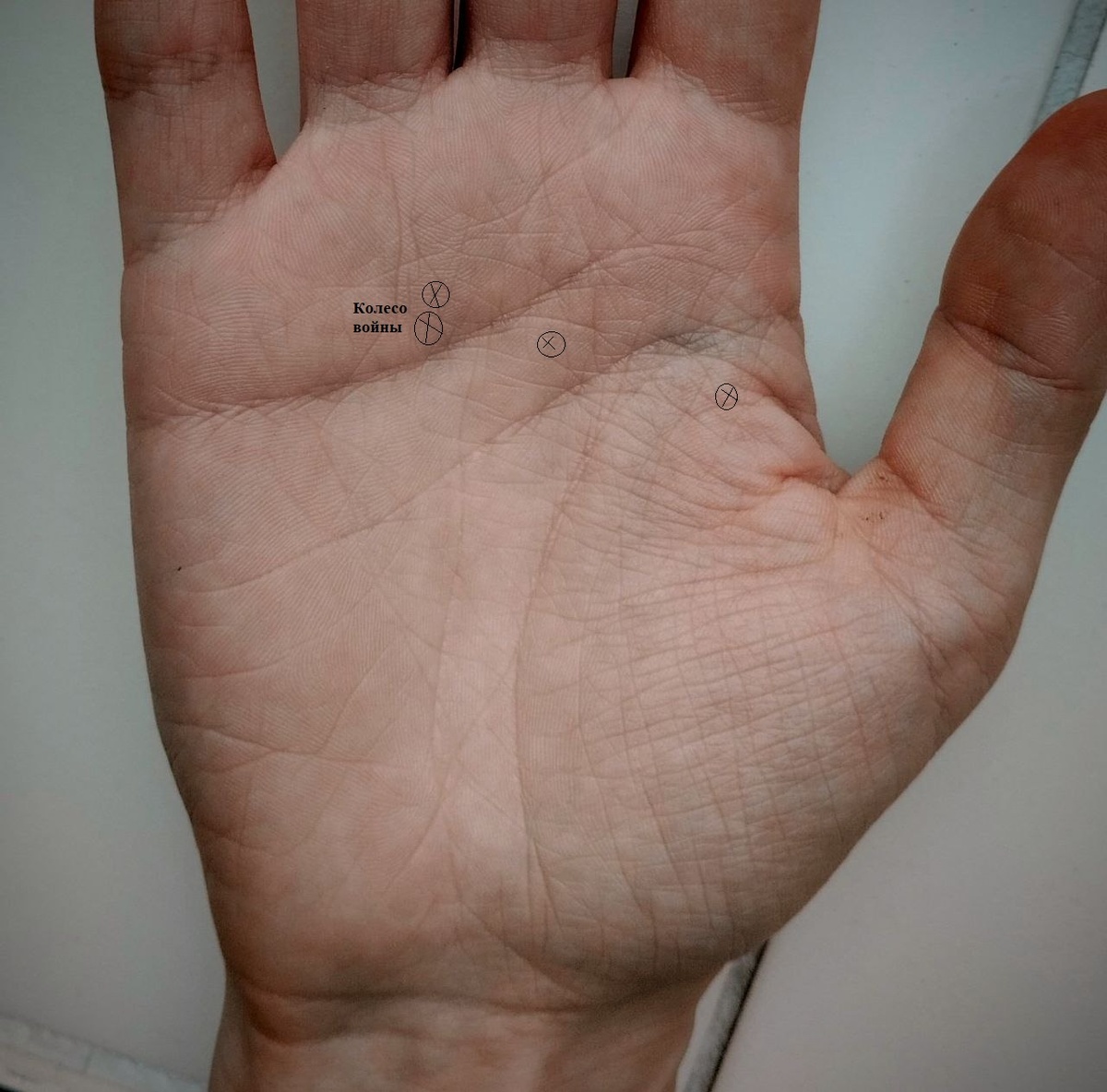 Два небольших знака расположены над Линией Сердца, на холме Аполлона, на стрессовой линии/линии обиды над Линией Ума и на холме Марса.