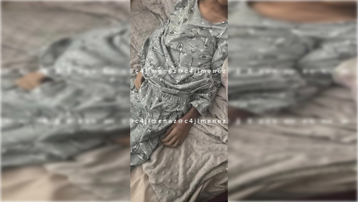 Фото состояния мальчика, когда его нашли / x.com (заблокирован в РФ)/c4jimenez