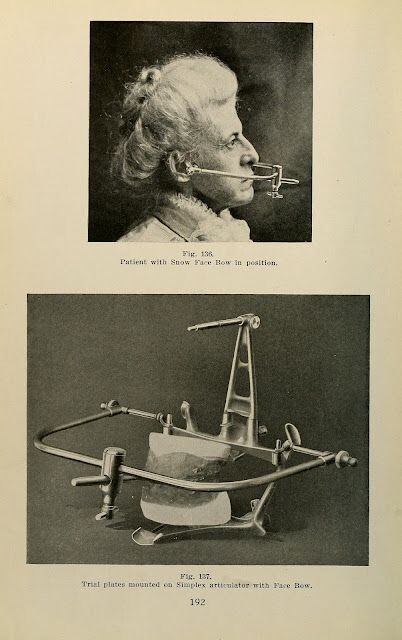 Prosthetic Articulation by George Wood Clapp, 1914 год.