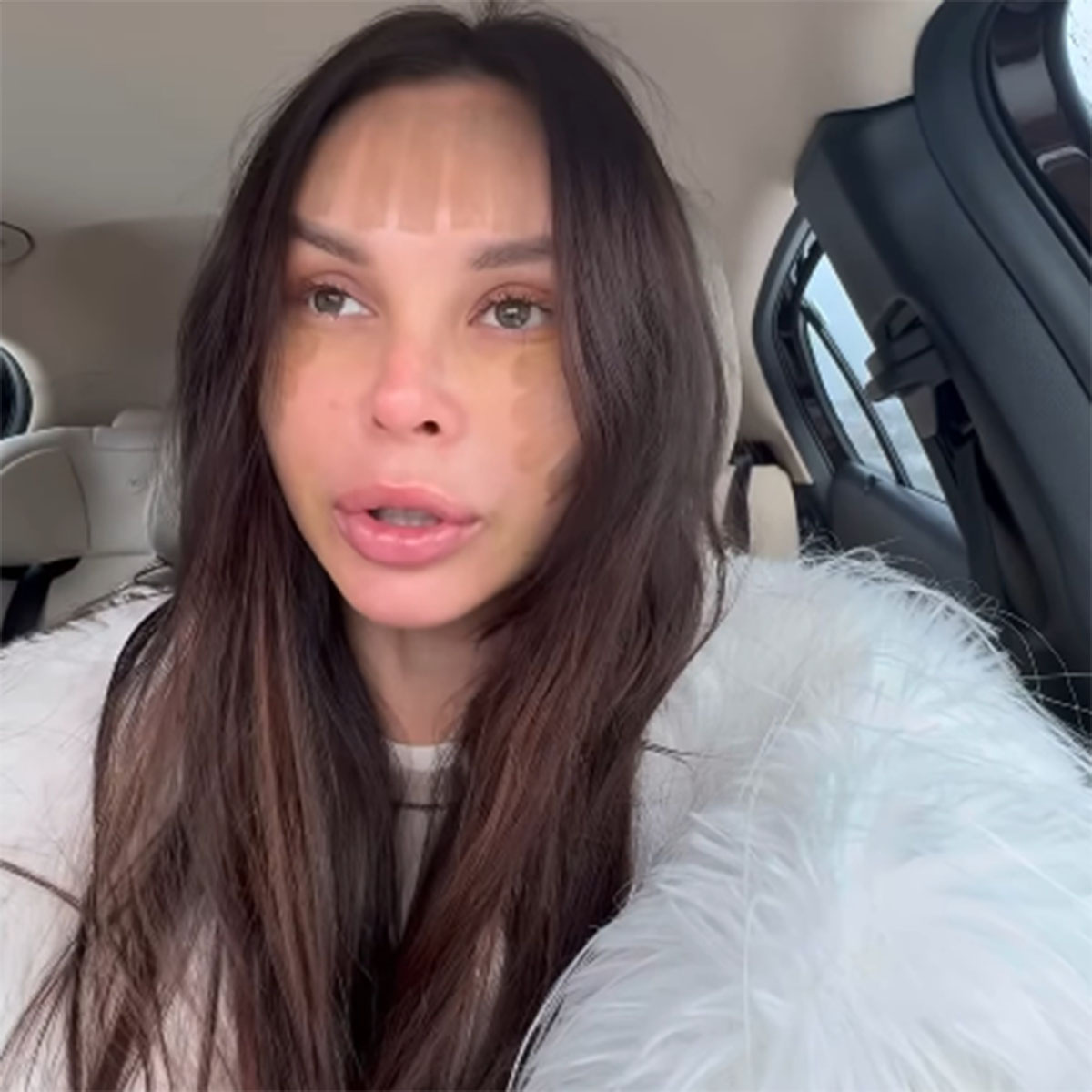 Настя Лисова после операции. Фото: соцсети Насти Лисовой