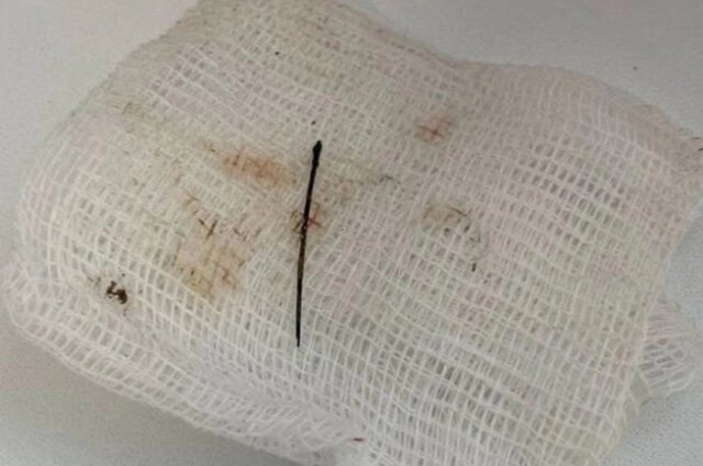    Та самая игла! Фото: Из архива/ ГКБ № 6 Твери