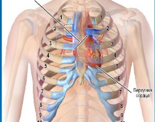 Блокада левой ножки пучка Гиса. Случай в реанимации.
