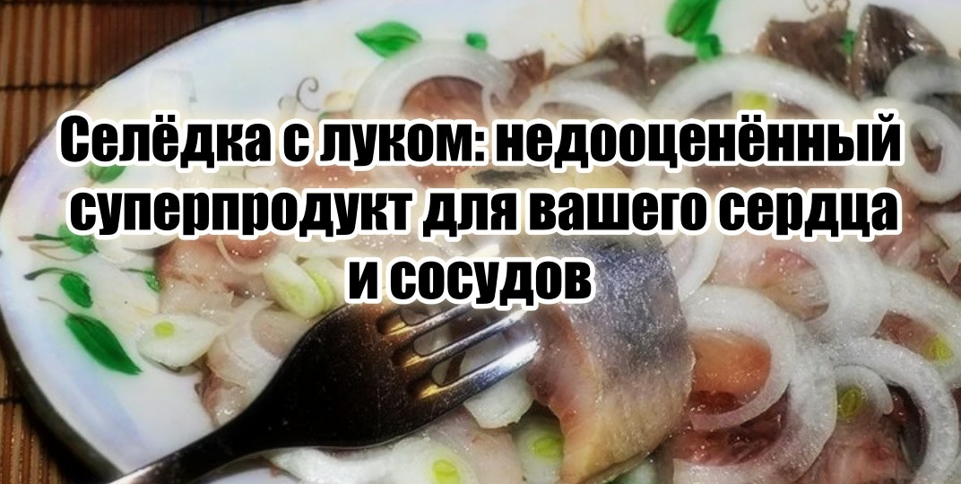 Не сёмга и форель, а обычная селёдка с луком – настоящая спасительница для наших сосудов и сердца