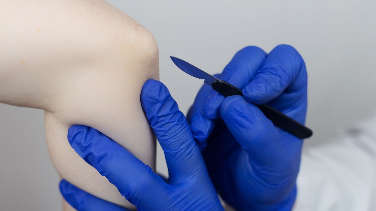 Эндопротезирование: как вернуть суставам свободу и избавиться от боли?