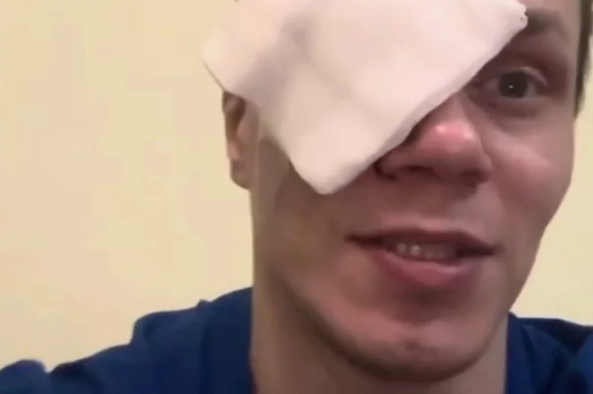    Блогеру и бойцу поп-ММА Тарасову выбила левый глаз нетрезвая подруга