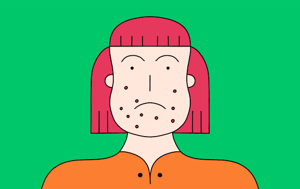 Чтобы не было зловредных прыщей при СКПЯ - питайся правильно и чисто! Полностью исключи сахар!