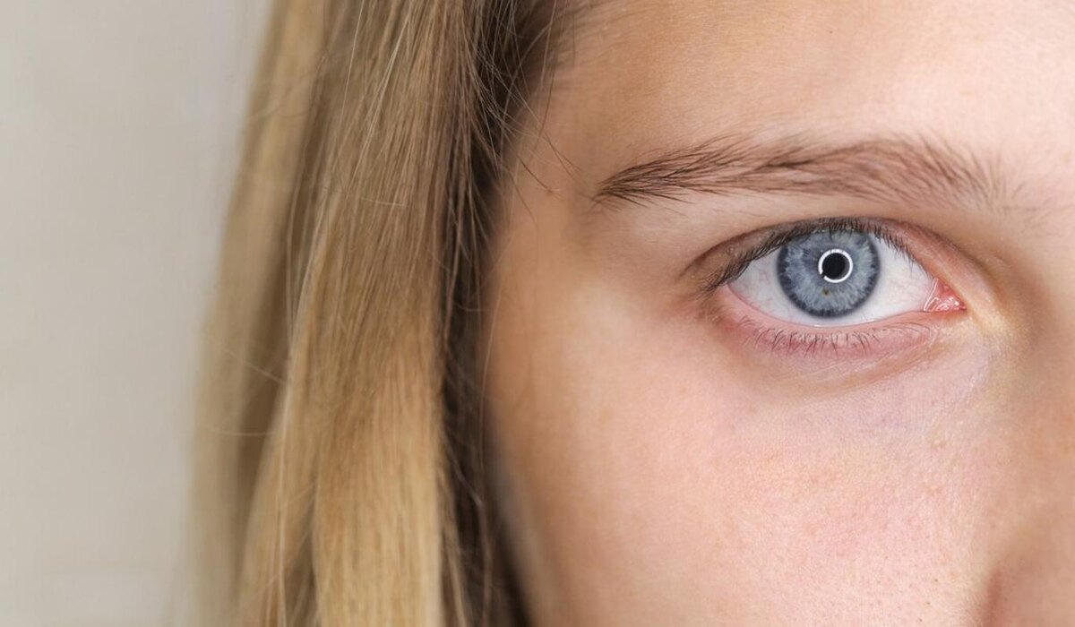     Тест на косоглазие: узнай, в зоне риска ли ты