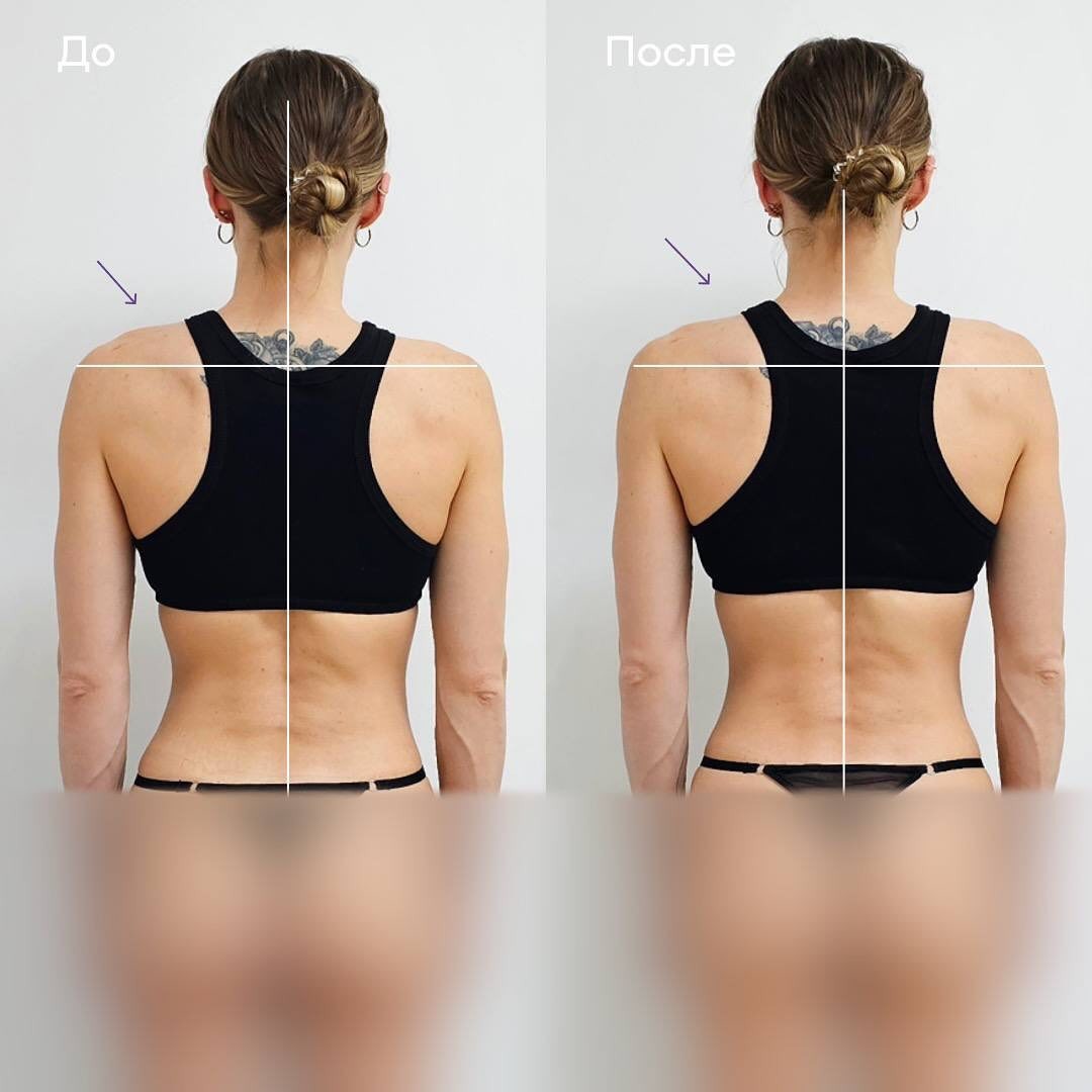 Клиника "Остео лайт"