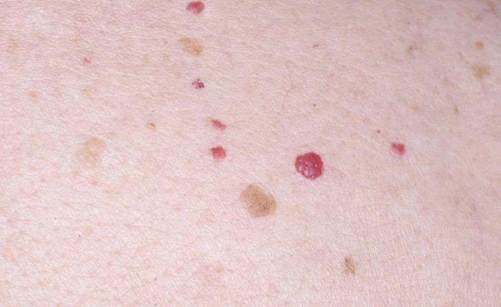 Фото из открытого источника