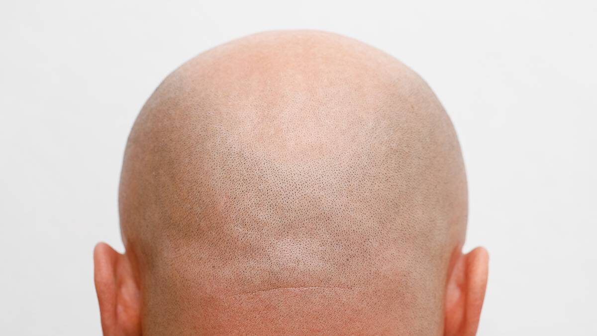    Фото: shutterstock