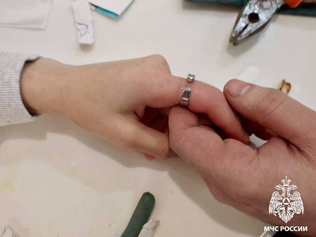 Не простое украшенье! В МЧС Тверской области сняли с пальца девушки кольцо