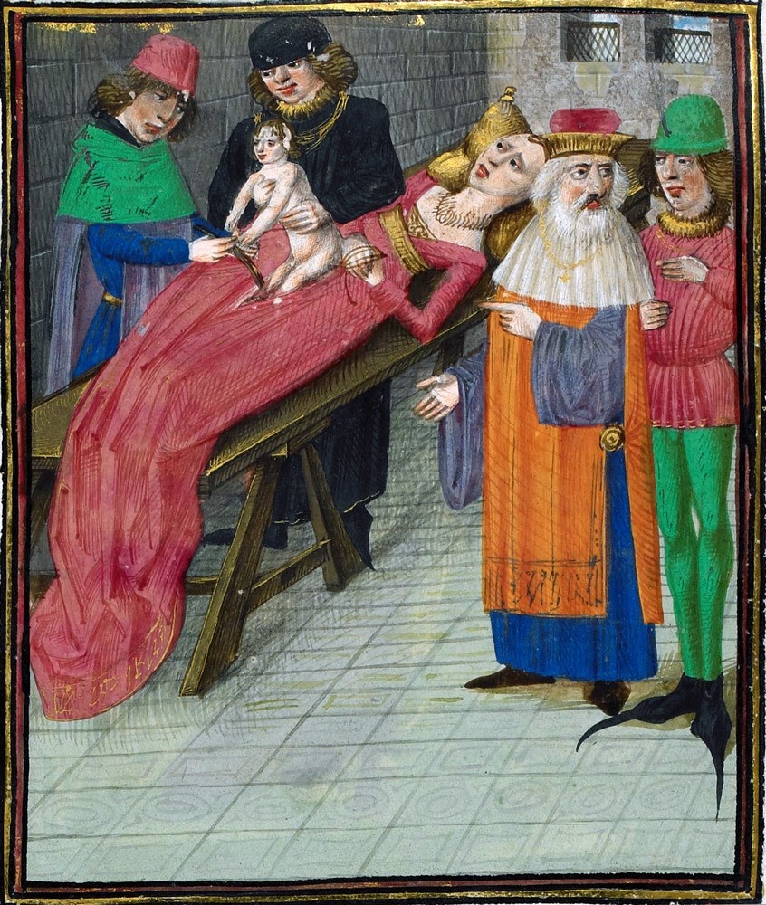 Рождение Цезаря. Миниатюра из манускрипта «Записки о Галльской войне» под авторством Цезаря. Франция, 1473–1476 годы