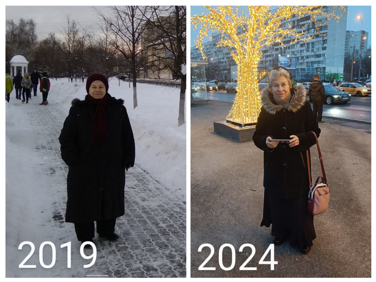 Не тяните до 70 лет, худейте раньше, оно того стоит.