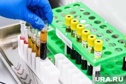    Ранее по факту смерти Коробкова-Землянского провели судмедэкспертизу