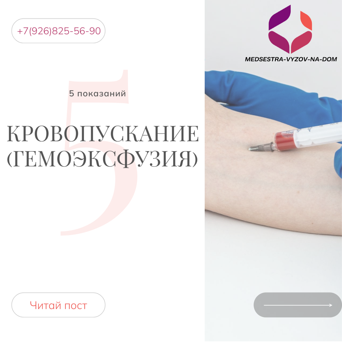 Кровопускание венозной крови (гемоэксфузия)
