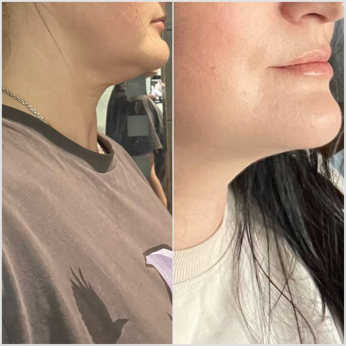 До и после использования крема BIJOU DE MER