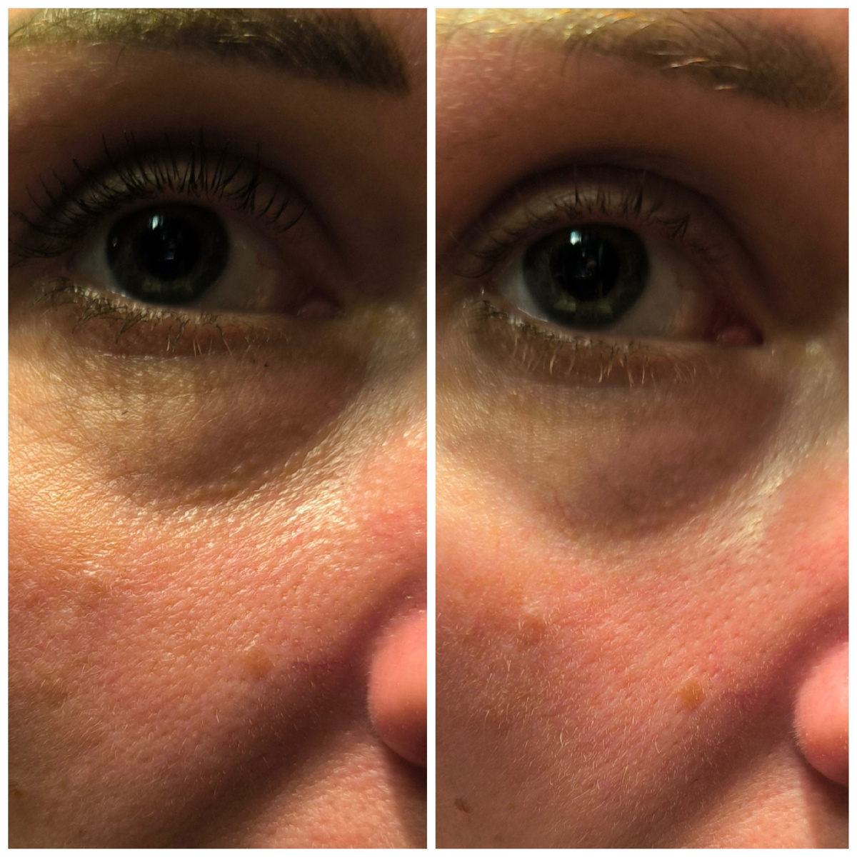 Мои фото ДО и ПОСЛЕ, разница 3 минуты